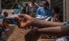 France reports first case of new mpox variant