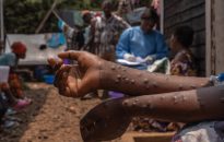 France reports first case of new mpox variant