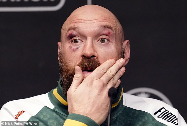 Tyson Fury backed to land new job immediately after announcing boxing retirement