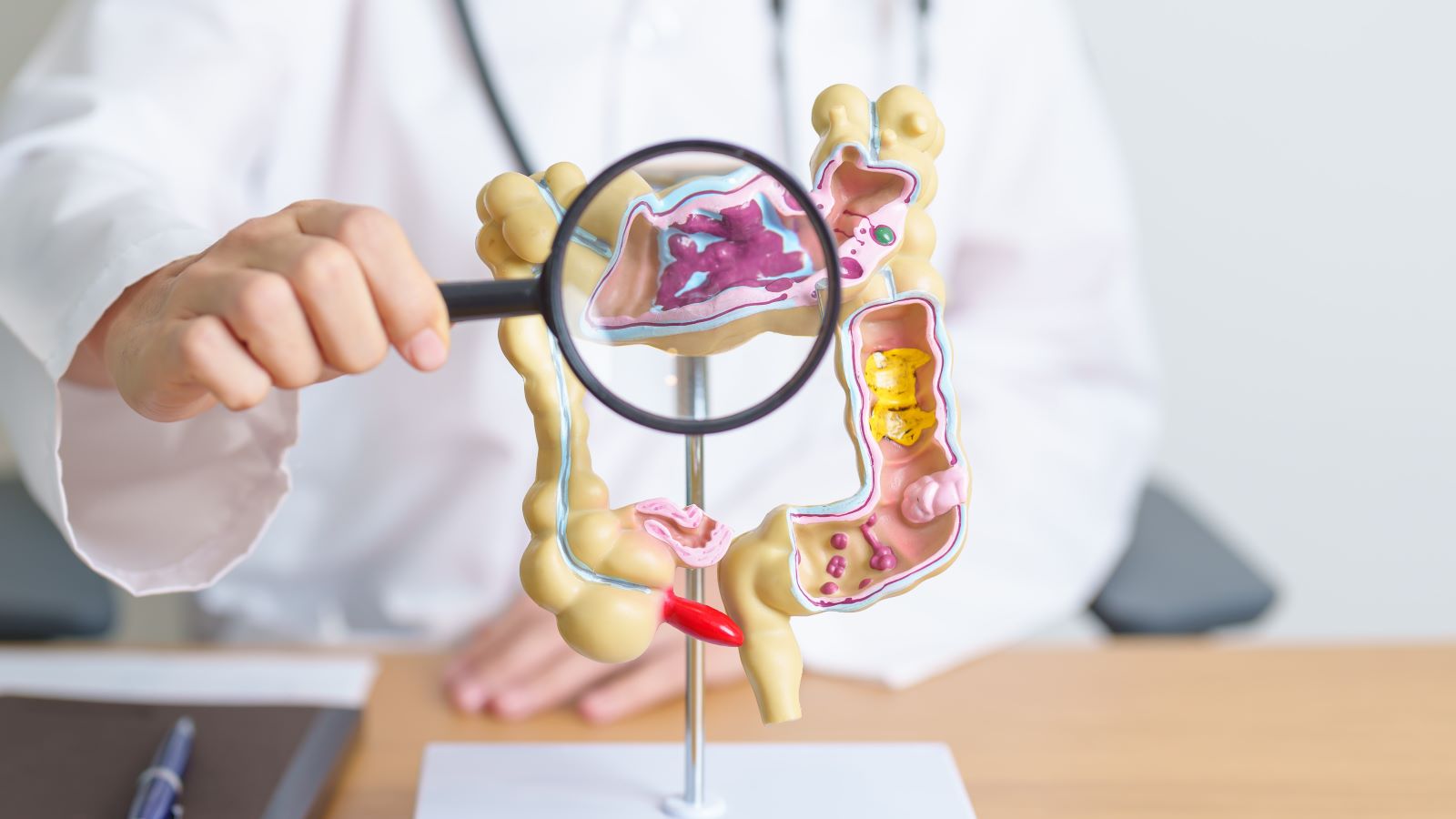 How a new online tool is helping people of any age assess their colon cancer risk