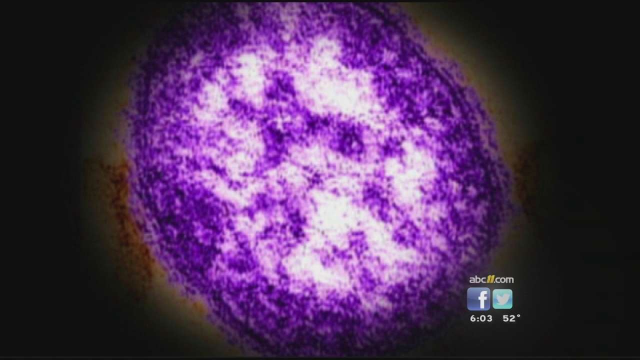 Measles case confirmed in Shelby County