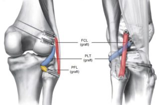 Injury