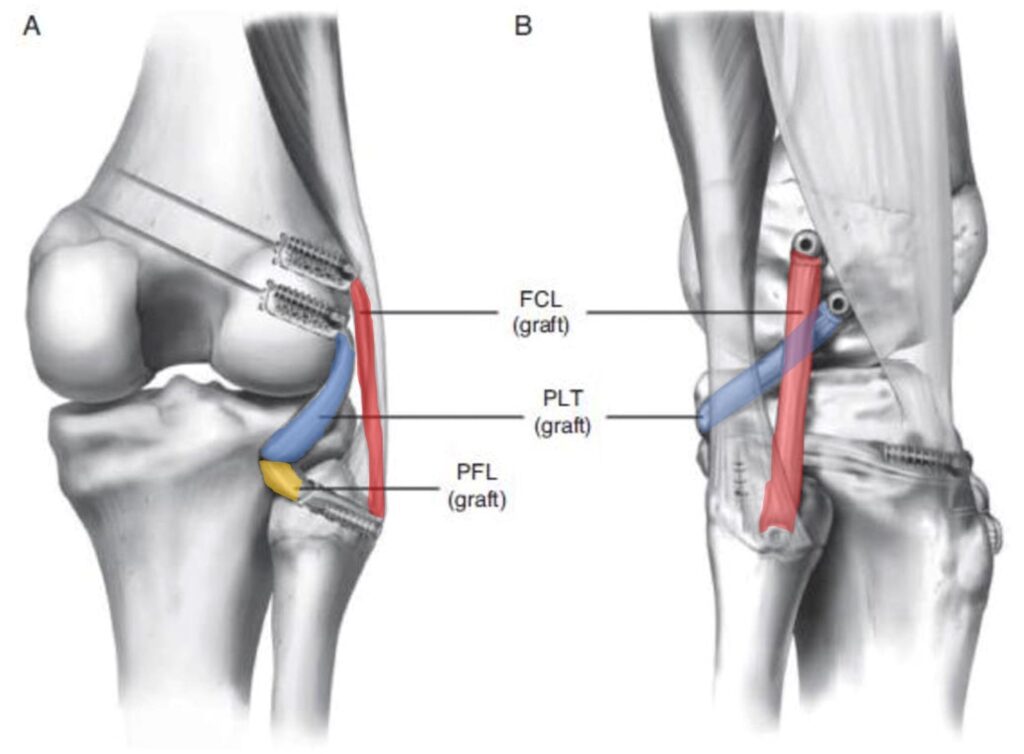 Injury