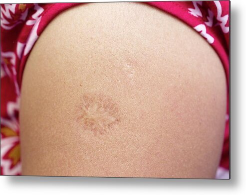 That left a mark