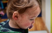 Track the spread of measles in Texas