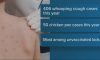 Whooping cough cases on the rise with measles