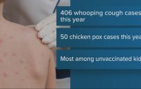Whooping cough cases on the rise with measles