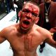 Nate Diaz issues X