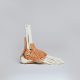 Shoes that can warn you about injuries? How wearable technology is transforming foot care