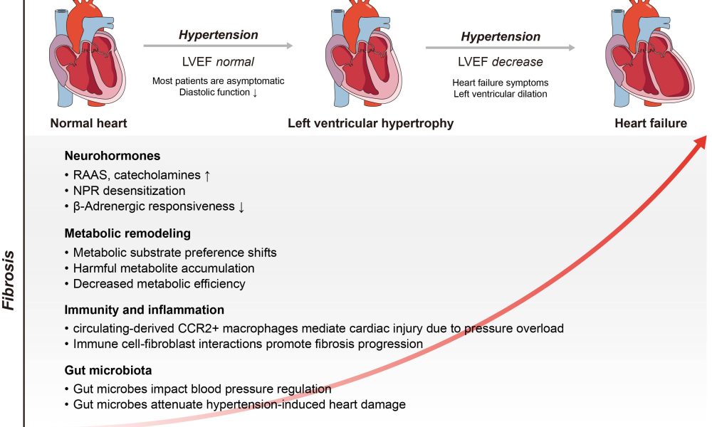 NIL changes everything; UA adjusts